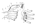 Microarterial Bridge